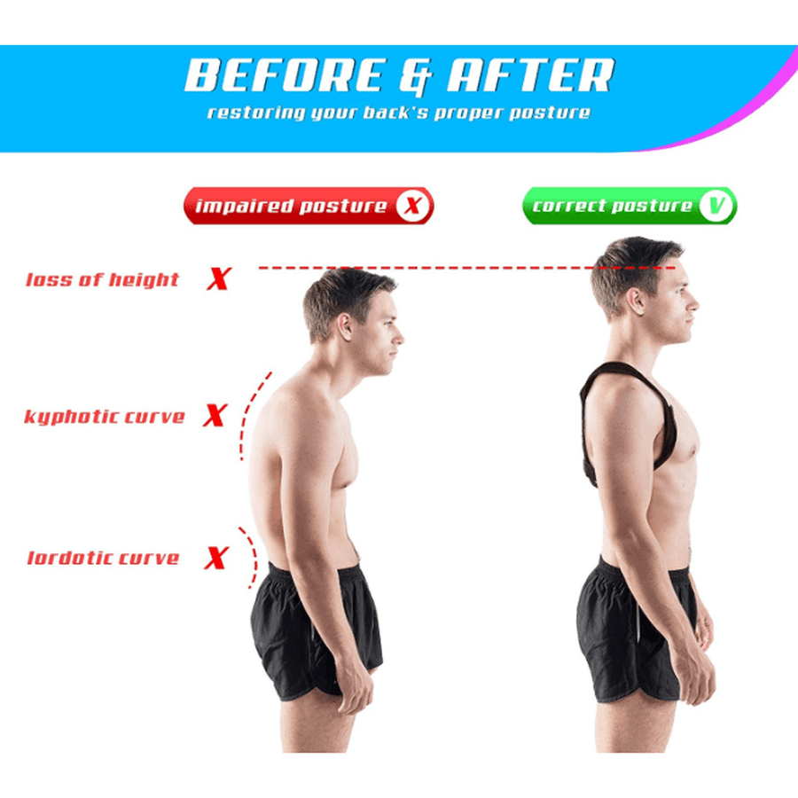 Adjustable Posture Corrector - Back Support & Pain Relief Posture Corrector Upliftex