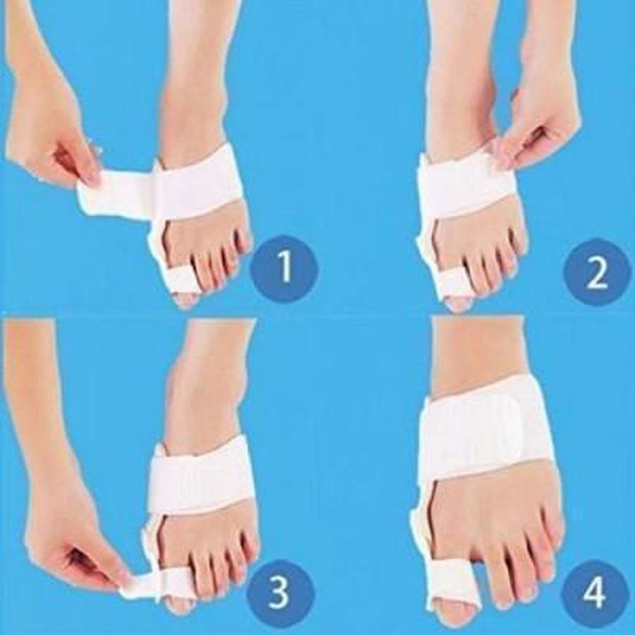 Bunion Corrector Splint Brace Adjustable Hinged Big Toe Straightener Bunion Corrector upliftex