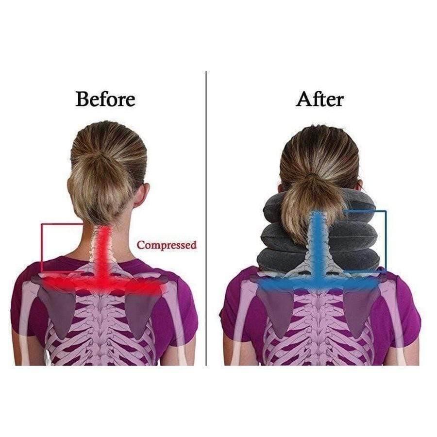 Inflatable Cervical Neck Traction Device - Instant Neck Pain Relief Neck Pain Relief upliftex