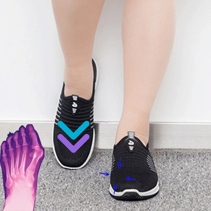 bunion correcting sneakers casual flats for women 912932