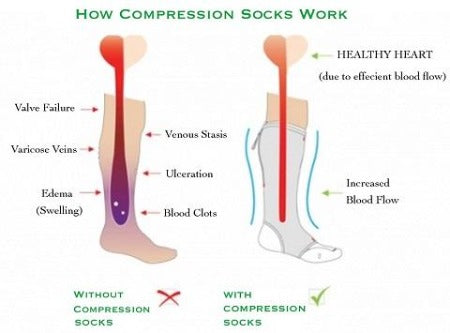 Compression Socks for Men and Women - Support Stockings ~ 9 Colors!